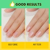 image:imageFANDAMEI Nail Files and Buffers Manicure Tools Nail Care Kit with Nail File Nail Buffer Block Cuticle Care for Women with Nippers Pusher Peeler Cuticle Oil and Nail Prep KitBMilkHoney